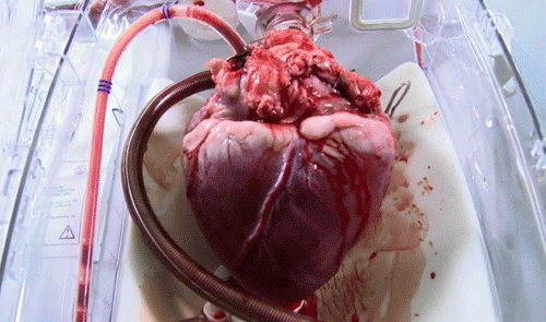 Trái tim thật, không phải trái tim tô vẽ