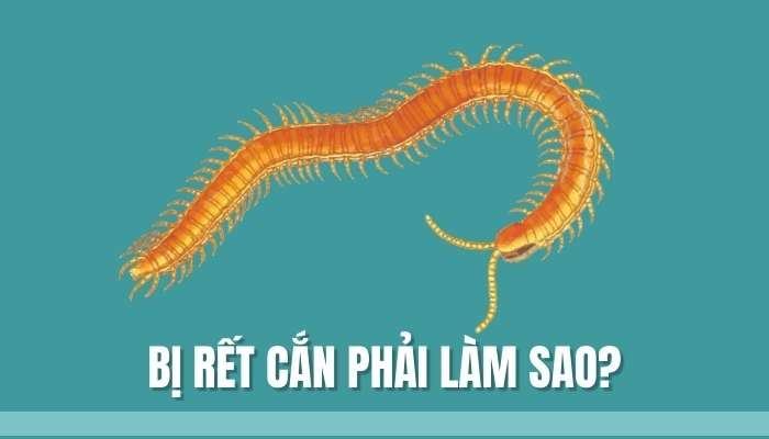 Bị rết cắn có sao không? Dấu hiệu và cách xử lý khi bị rết cắn